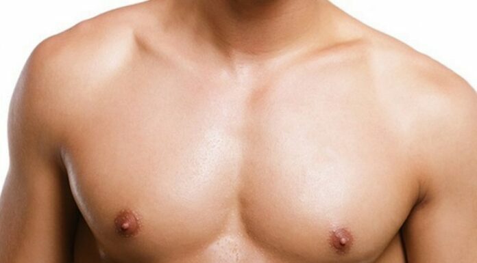 Management Of Enlarged Breast Tissue With Gynecomastia Doctors Management Of Enlarged Breast Tissue With Gynecomastia Doctors