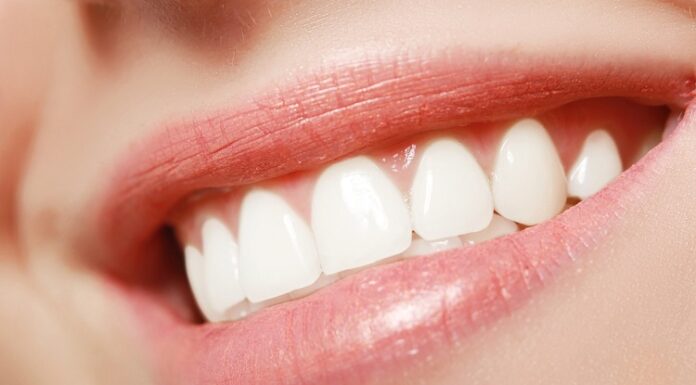 5 Essential Benefits of Having Straight Teeth Having Straight Teeth