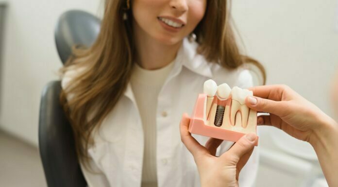 The Benefits Of Dental Implants For Seniors Dental Implants