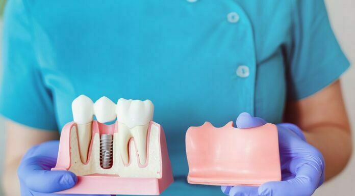 What Are The Different Ways To Replace Teeth? Replace Teeth