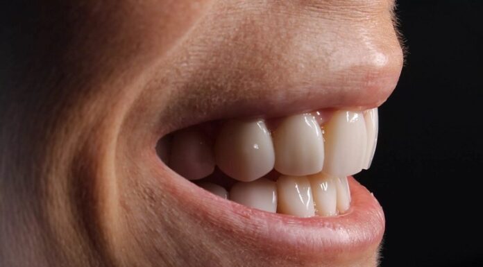 3 Reasons Why You Need a Teeth Whitening Kit Teeth Whitening Kit