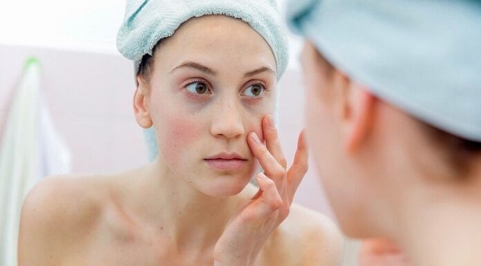 3 Benefits of Microneedling dermatologist