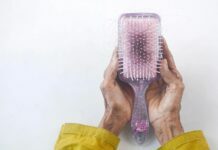 FAQs About Hair Transplant Procedures hair loss