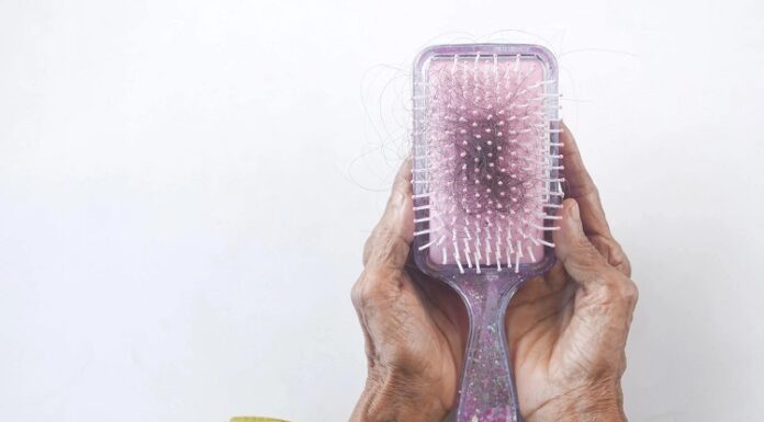 FAQs About Hair Transplant Procedures hair loss