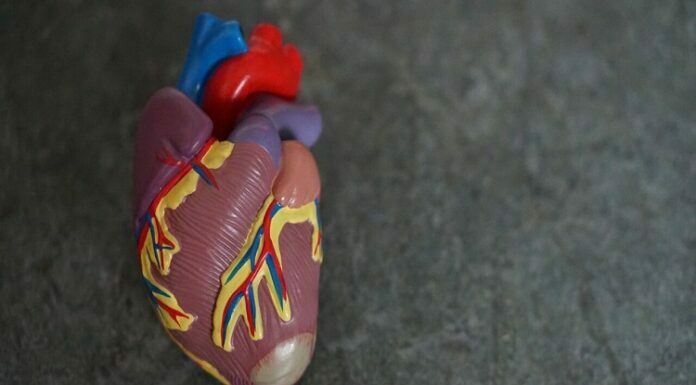 UNDERSTANDING ATRIAL FIBRILLATION AND ITS SYMPTOMS ATRIAL FIBRILLATION