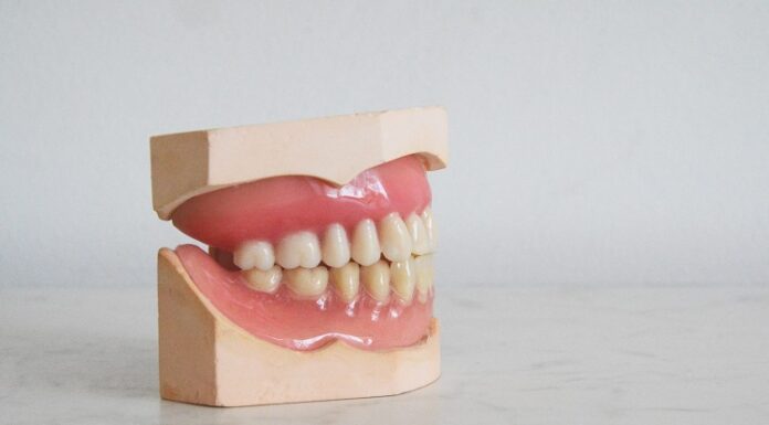 Dental Implants and Pregnancy: What You Need to Know Dental Implants
