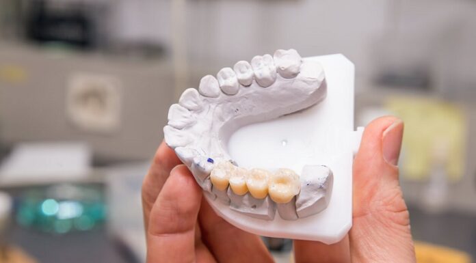 Unique Benefits of Dental Implants Dental Implants