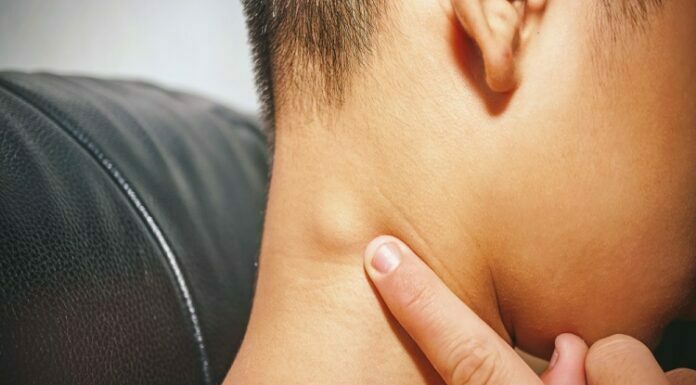 Essential Facts on Lymph Node Biopsy You Should Know About lymph node biopsy