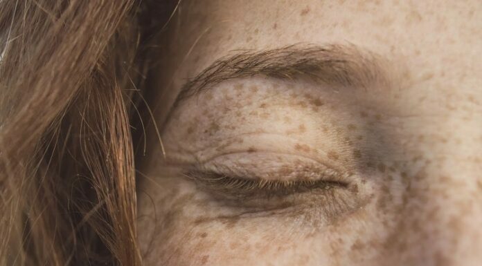 Tips To Prevent Squamous Cell Carcinoma Squamous Cell Carcinoma