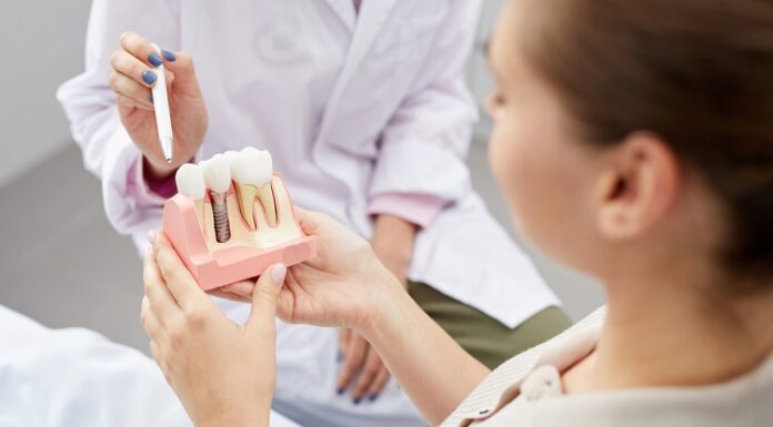 What Should You Expect from Your Dental Implants Placement? Dental Implants