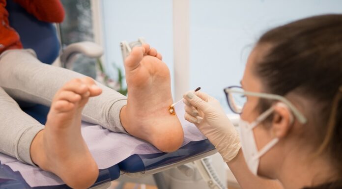 Effective Ways to Treat Plantar Warts Treat Plantar Warts