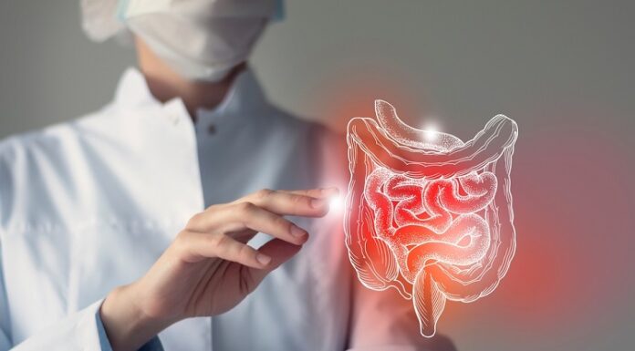 Non-Surgical Solutions For Crohn’s and Ulcerative Colitis Ulcerative Colitis