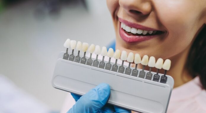 Veneers In London For Making A Great First Impression Veneers