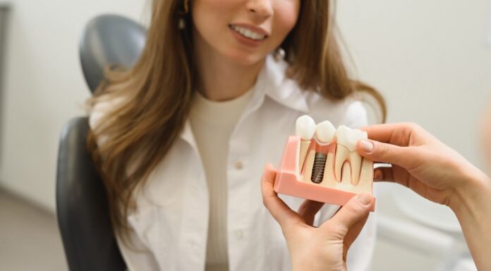 6 Reasons Why You Should Consider Having Dental Implants Dental Implants