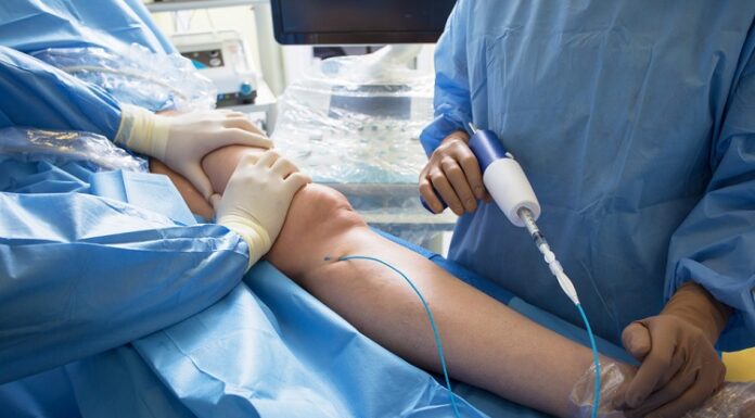 What to Expect During a Consultation with a Vascular Surgeon Vascular Surgeon