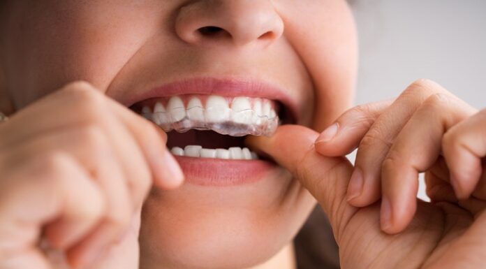 3 Reasons to Use a Night Guard in Richmond Night Guard