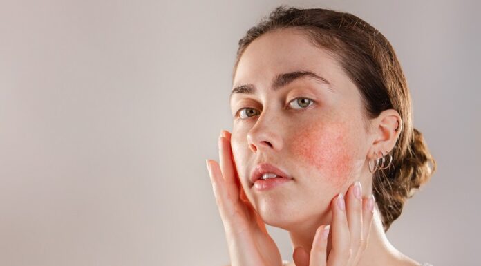 Skin Conditions That Are More Serious Than You Think Skin Conditions
