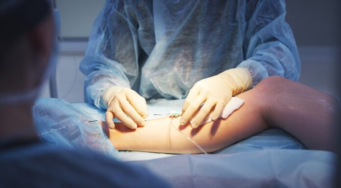 The Future of Vascular Surgery: Advancements and Innovations Vascular Surgery