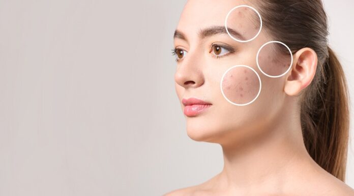 Why Regular Dermatologist Checkups are Important Dermatologist