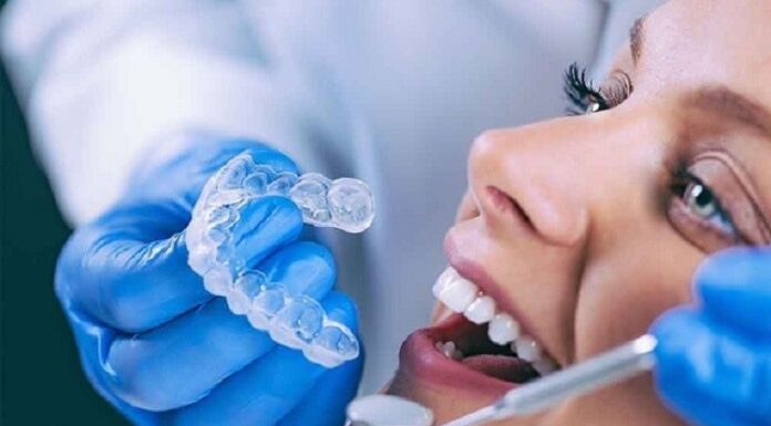 Unlocking the Secrets of Invisalign: The Future of Teeth Straightening Invisalign