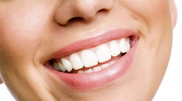 A Quick Guide to Teeth Whitening Teeth Whitening