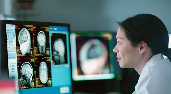 Understanding the Role of a Neurologist: What Do They Do? Neurologist