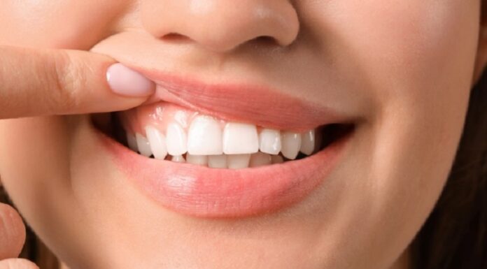 3 Reasons To Visit An Emergency Dentist For Gum Injury Gum Injury