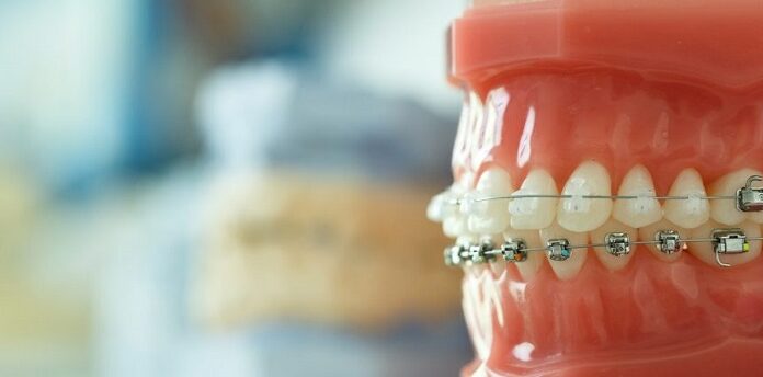 The Future of Orthodontics: Innovations and Trends to Watch Orthodontics