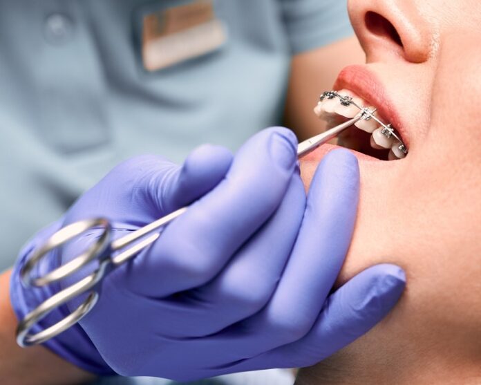 Braces